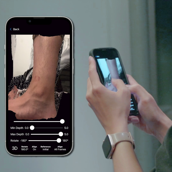 Image that shows what someone would see on the app when looking at an ankle